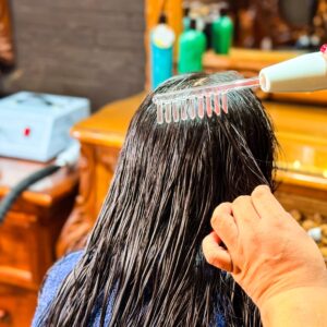 Tratamiento Radiofrecuencia Capilar